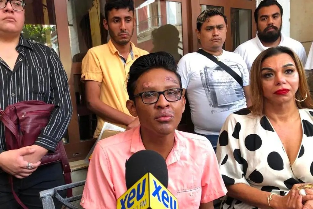 Pareja LGBT denuncia que policías estatales de Veracruz les robó y golpeó. Noticias en tiempo real