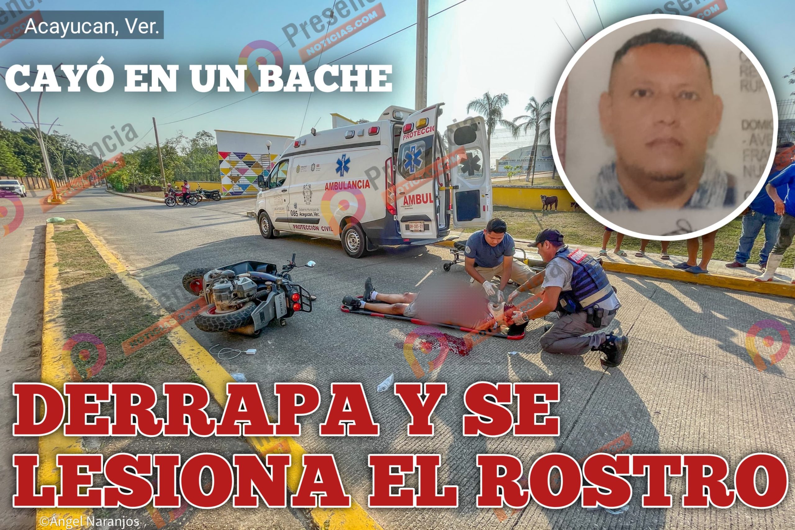 Grave de salud motociclista que derrapó frente a “El Greco” en Acayucan. Noticias en tiempo real